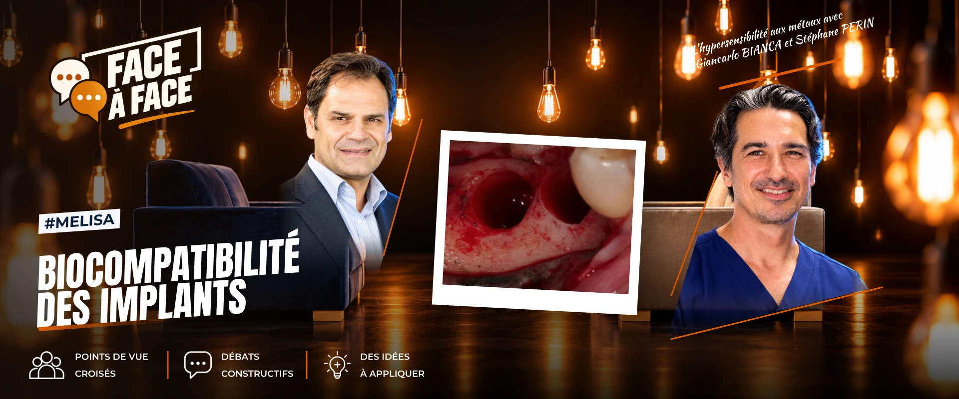 Biocompatibilité des implants (Face à Face, saison 2 épisode 26) : La biocompatibilité des implants en question : Giancarlo remet en cause l'idée…