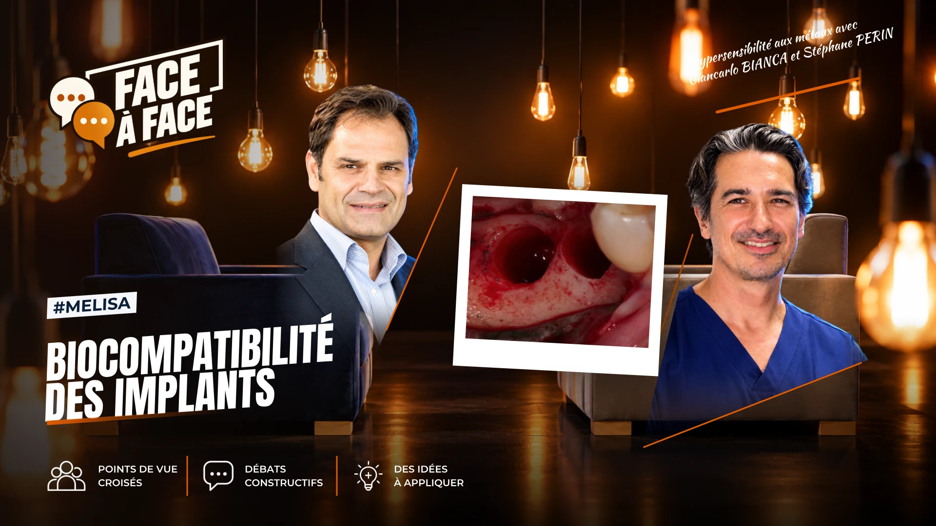 Biocompatibilité des implants (Face à Face, saison 2 épisode 26) : La biocompatibilité des implants en question : Giancarlo remet en cause l'idée…