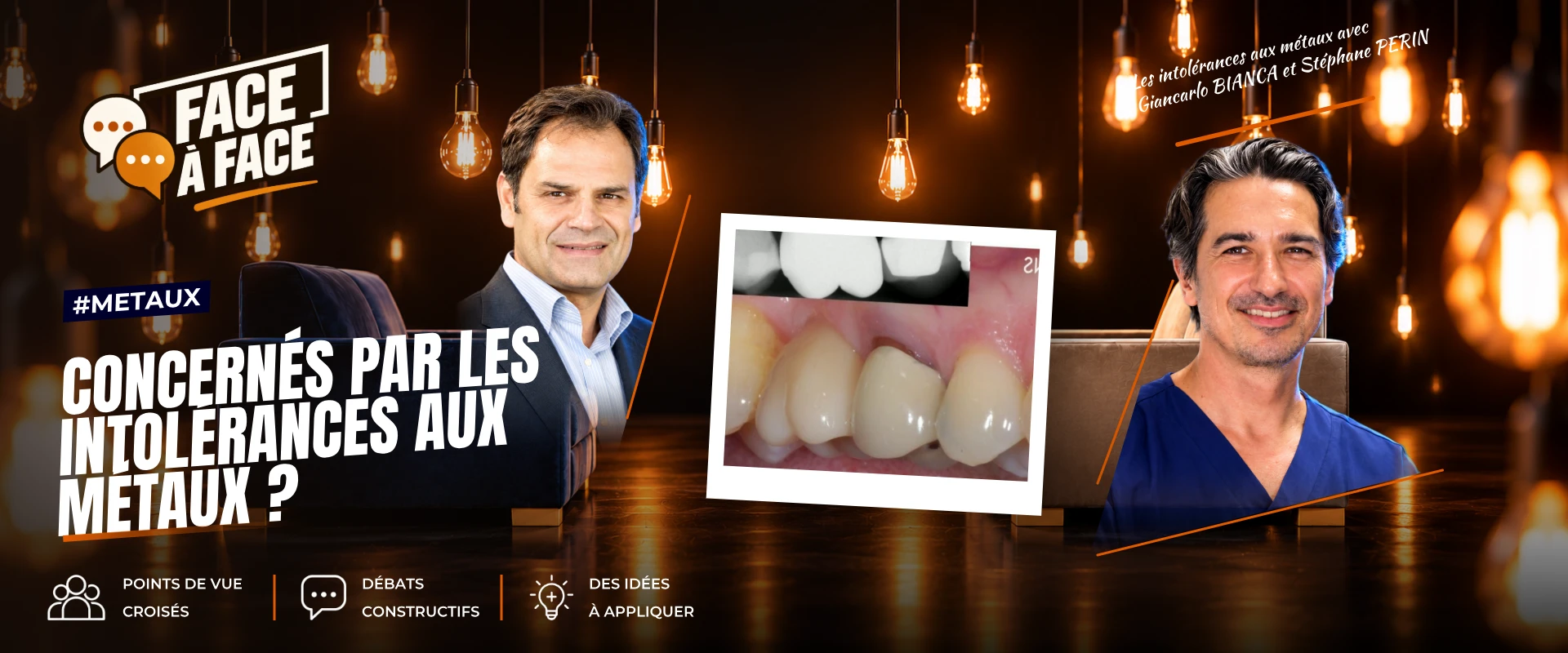 Les chirurgiens- dentistes sont ils les seuls concernés par les intolérances aux métaux ? (Face à Face, saison 2 épisode 27)