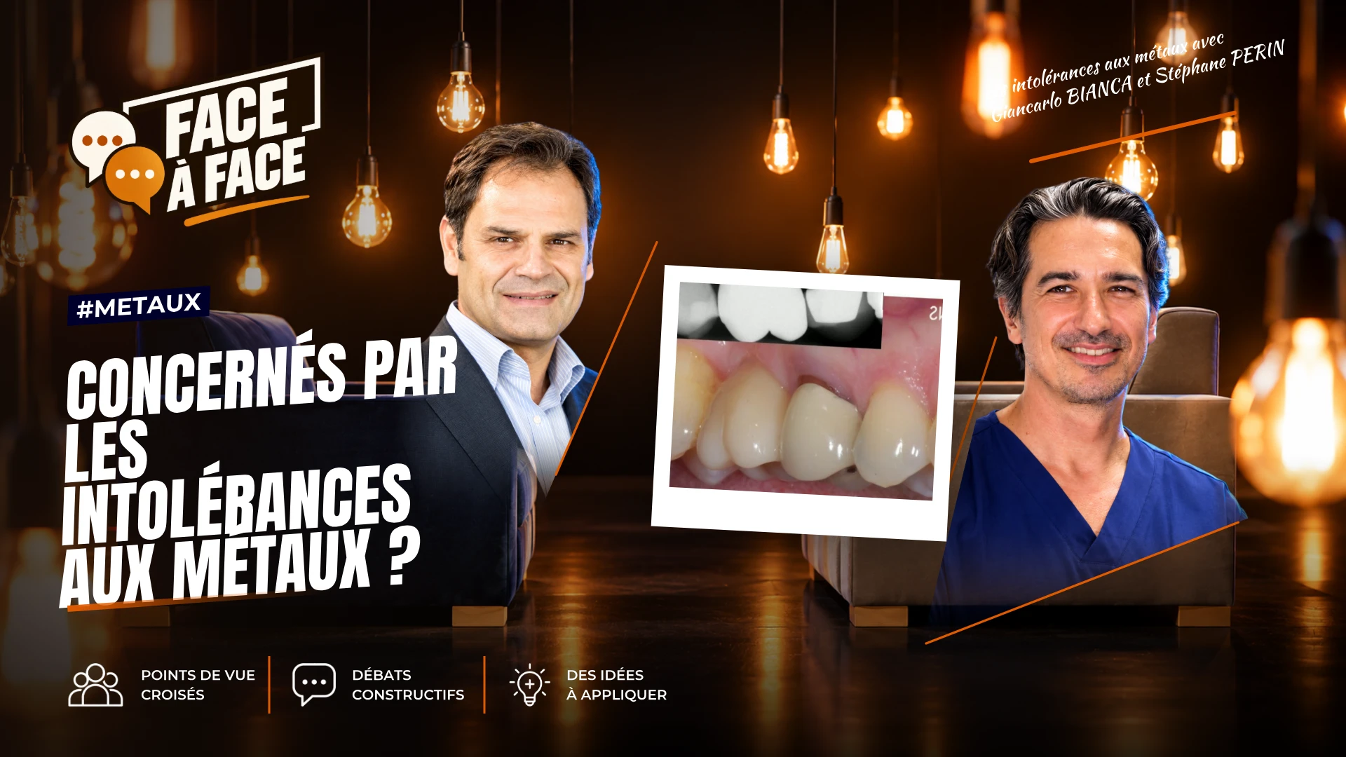 Les chirurgiens- dentistes sont ils les seuls concernés par les intolérances aux métaux ? (Face à Face, saison 2 épisode 27)