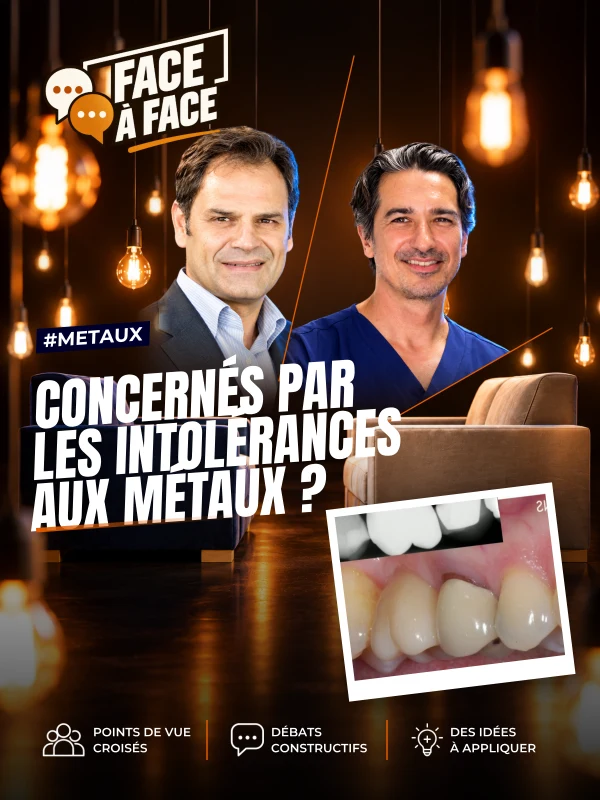 Les chirurgiens- dentistes sont ils les seuls concernés par les intolérances aux métaux ? (Face à Face, saison 2 épisode 27)