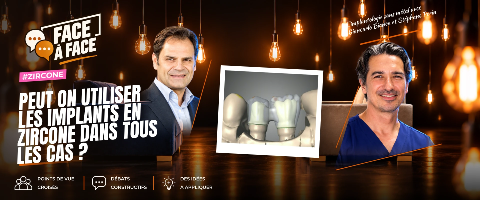 Peut on utiliser les implants en zircone dans tous les cas ? (Face à Face, saison 2 épisode 28) : Peut-on utiliser les implants en zircone dans tous…