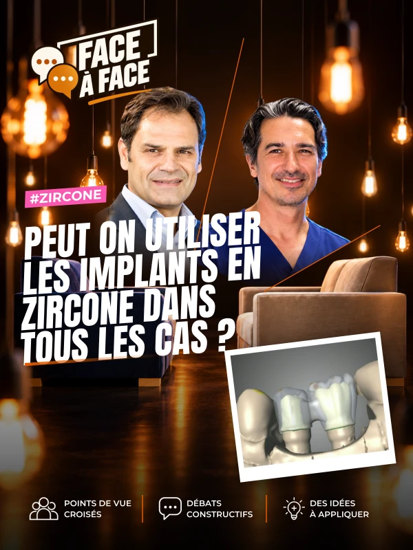 Peut on utiliser les implants en zircone dans tous les cas ? (Face à Face, saison 2 épisode 28) : Peut-on utiliser les implants en zircone dans tous…