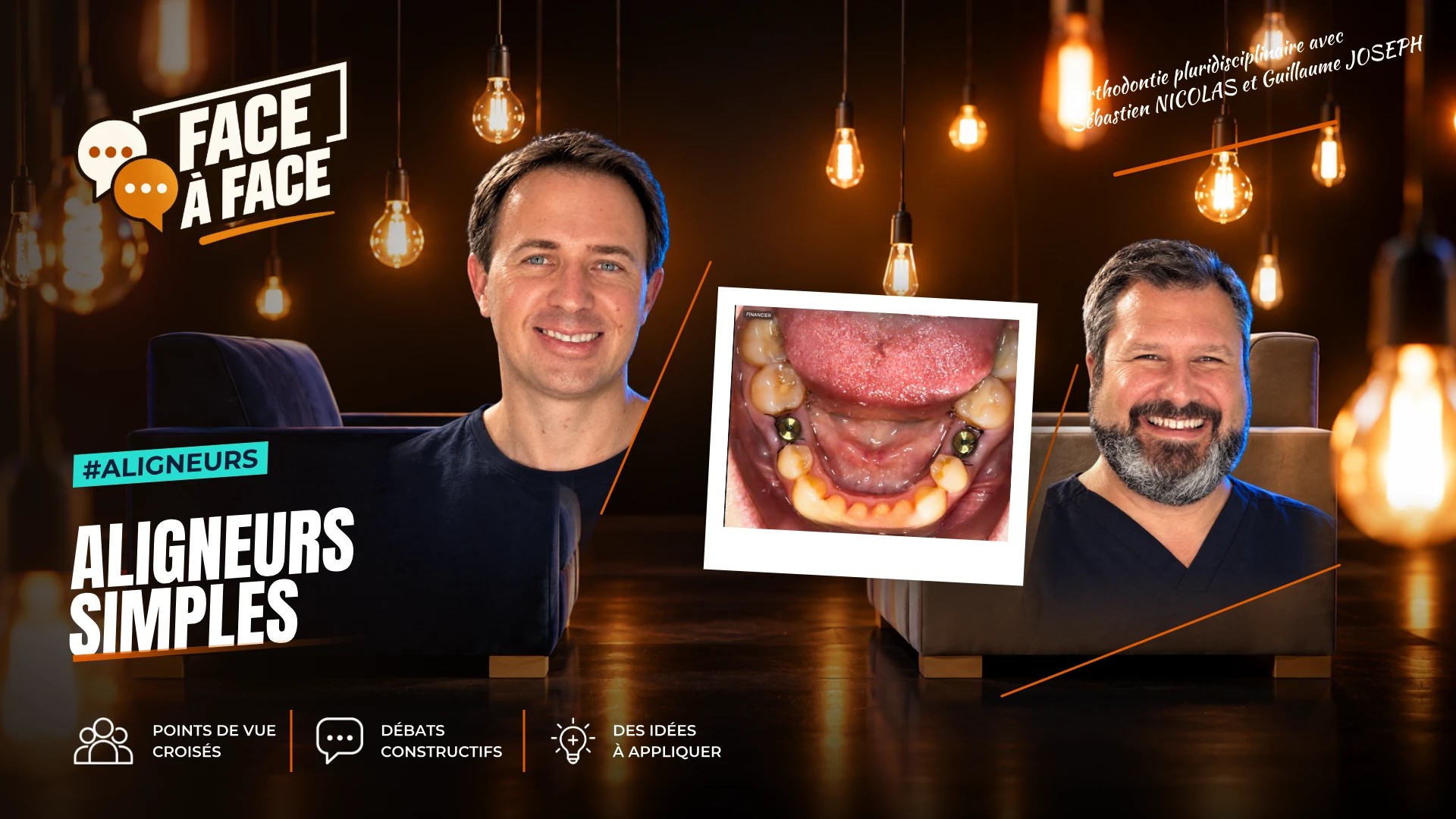 Aligneurs simples (Face à Face, saison 2 épisode 31) : Aligneurs, cas simple : un cas ortho-implanto en classe III légère qui rappelle que tout se…
