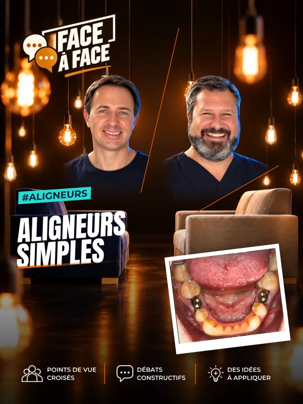 Aligneurs simples (Face à Face, saison 2 épisode 31) : Aligneurs, cas simple : un cas ortho-implanto en classe III légère qui rappelle que tout se…
