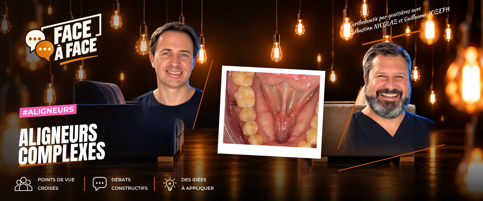Aligneurs complexes (Face à Face, saison 2 épisode 32) : Aligneurs, cas complexe : classe II, asymétrie et latérodéviation.