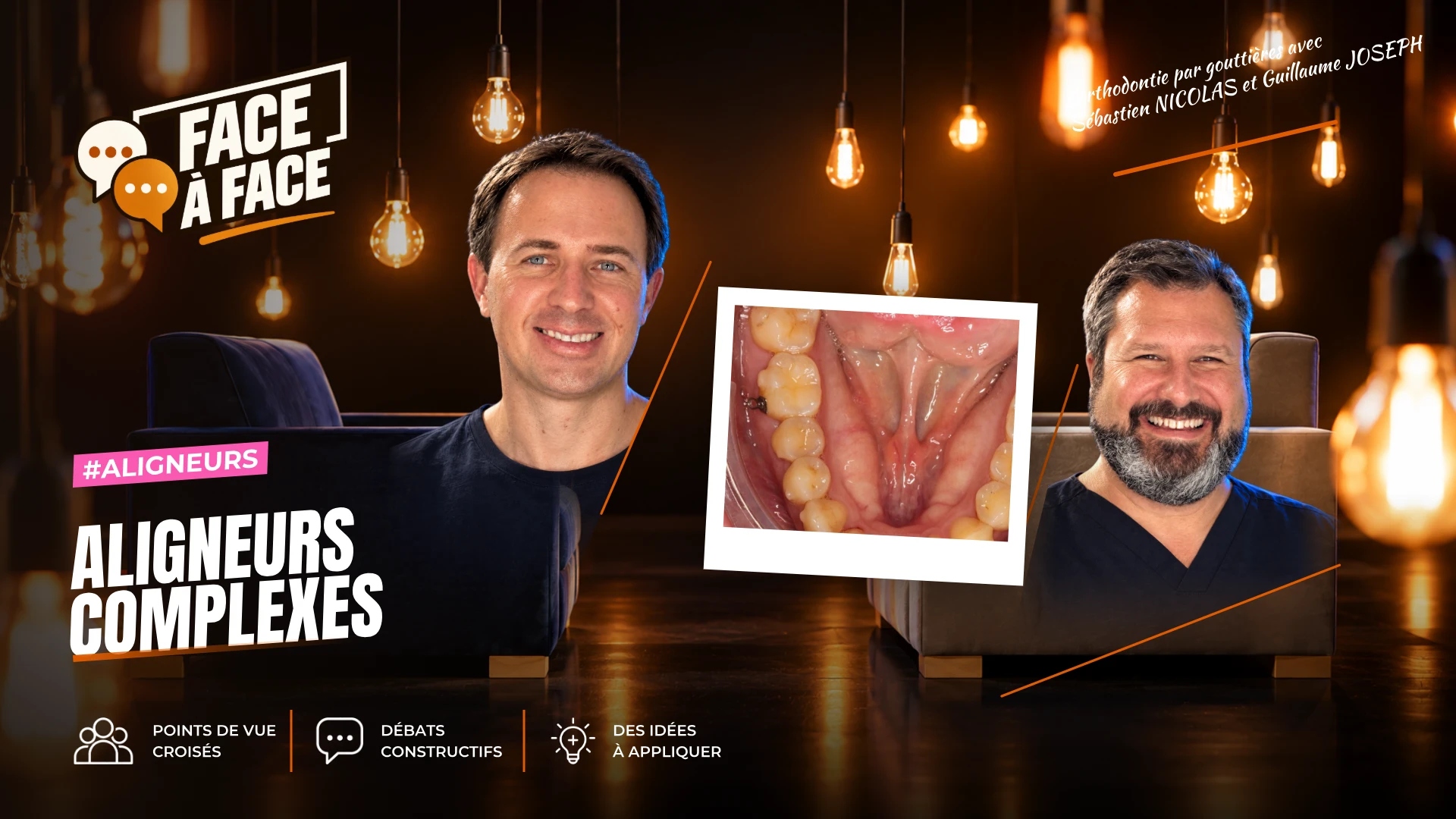 Aligneurs complexes (Face à Face, saison 2 épisode 32) : Aligneurs, cas complexe : classe II, asymétrie et latérodéviation.