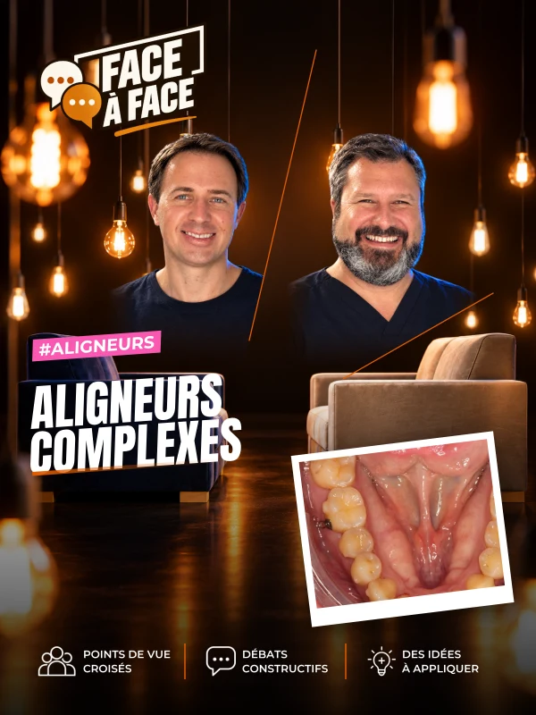 Aligneurs complexes (Face à Face, saison 2 épisode 32) : Aligneurs, cas complexe : classe II, asymétrie et latérodéviation.