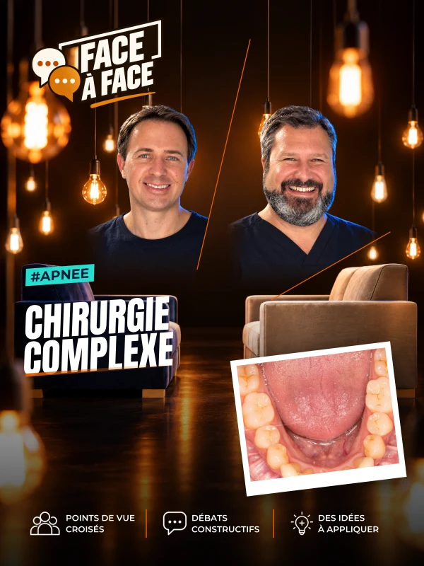 Chirurgie complexe (Face à Face, saison 2 épisode 33) : Chirurgie, cas complexe : une patiente de 29 ans en apnée sévère traitée en équipe…