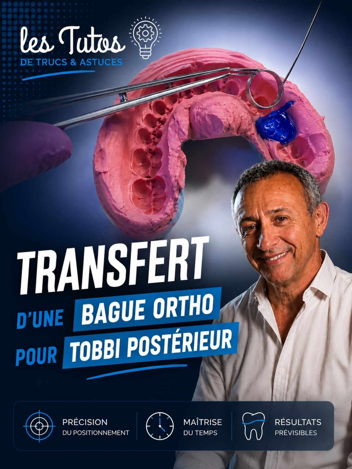 Transfert d une bague ortho pour tobbi postérieur (Tuto, saison 2 épisode 7) : Démonstration muette du Dr Jean Richelme : transférer une bague…