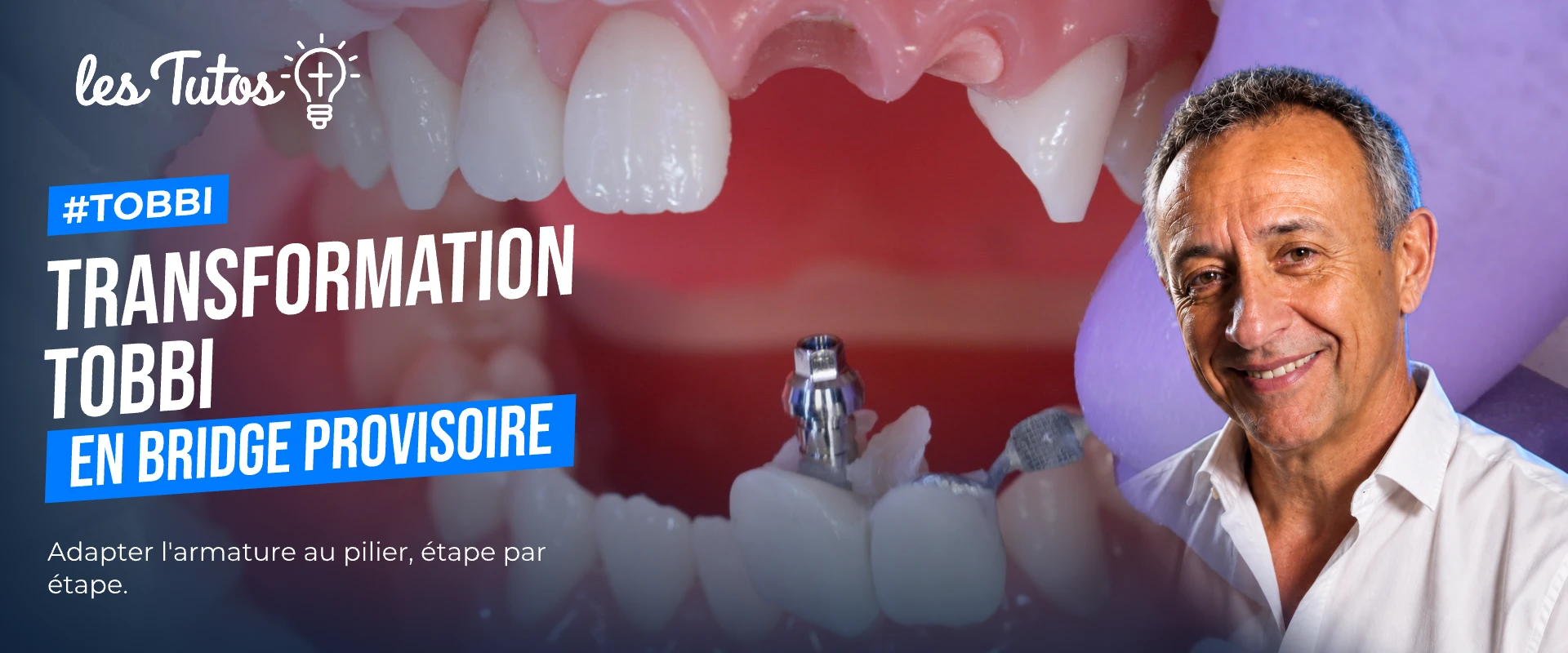 Transformation tobbi en bridge provisoire
