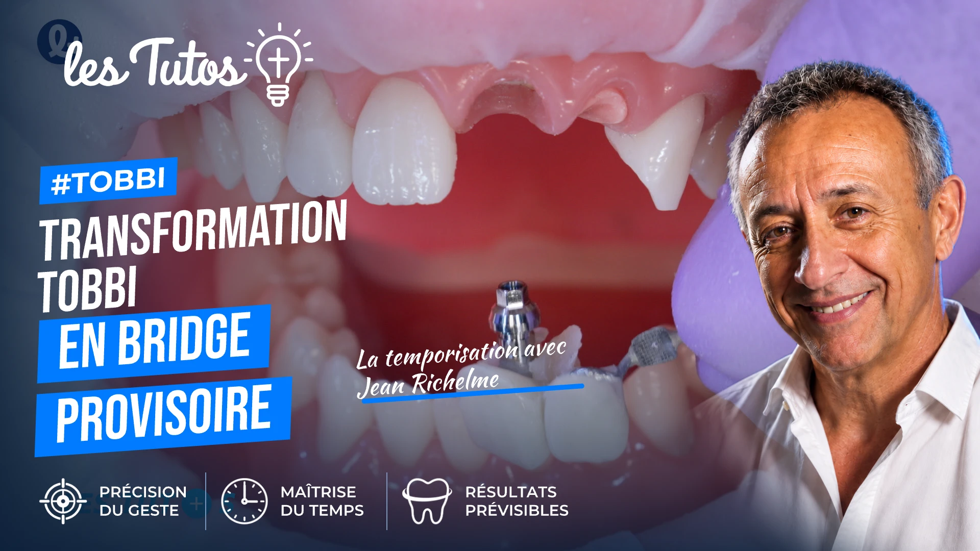 Transformation tobbi en bridge provisoire