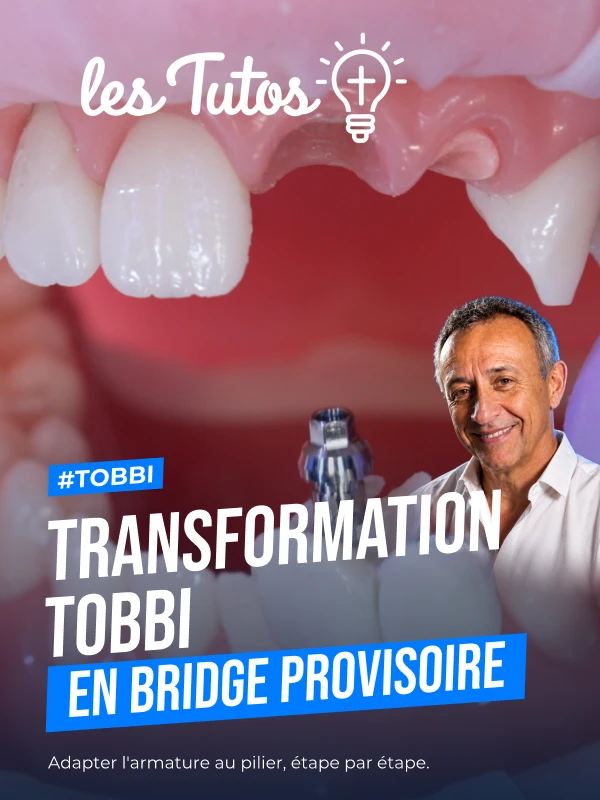 Transformation tobbi  en bridge provisoire