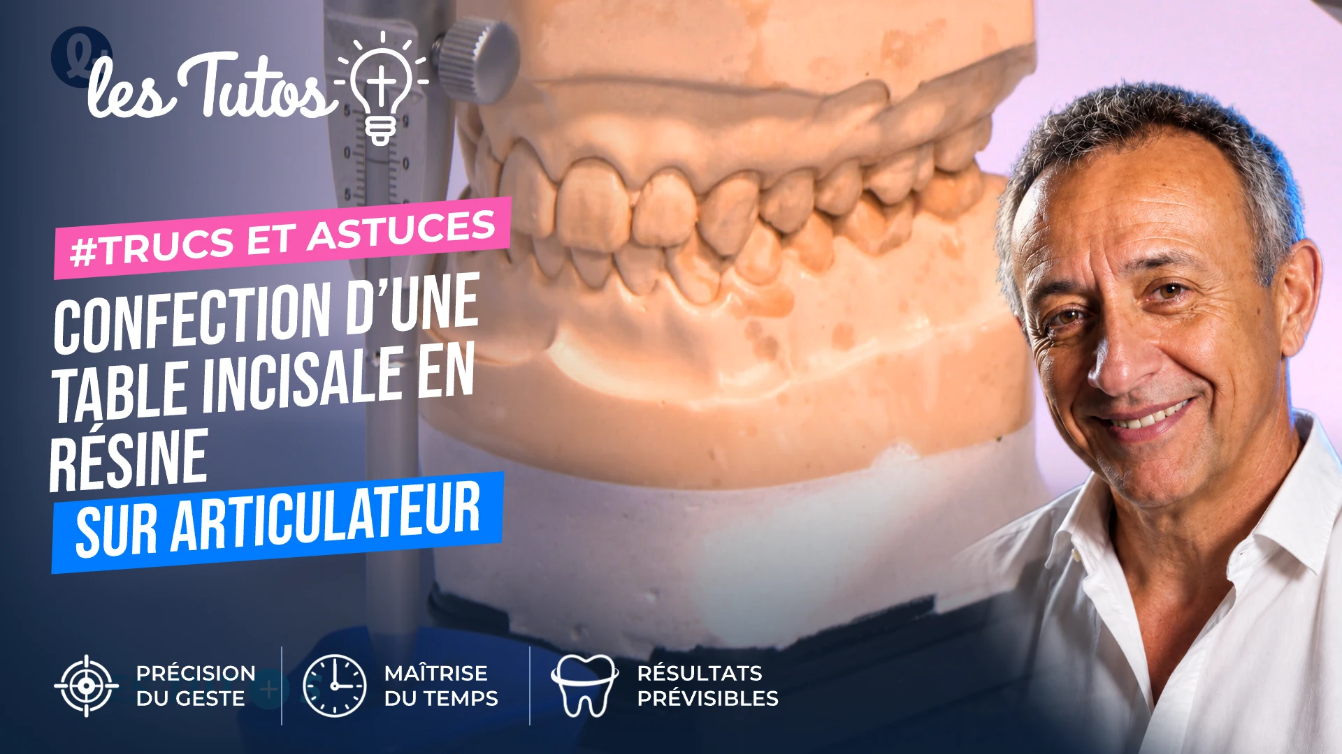 Confection d’une table incisale en résine sur articulateur
