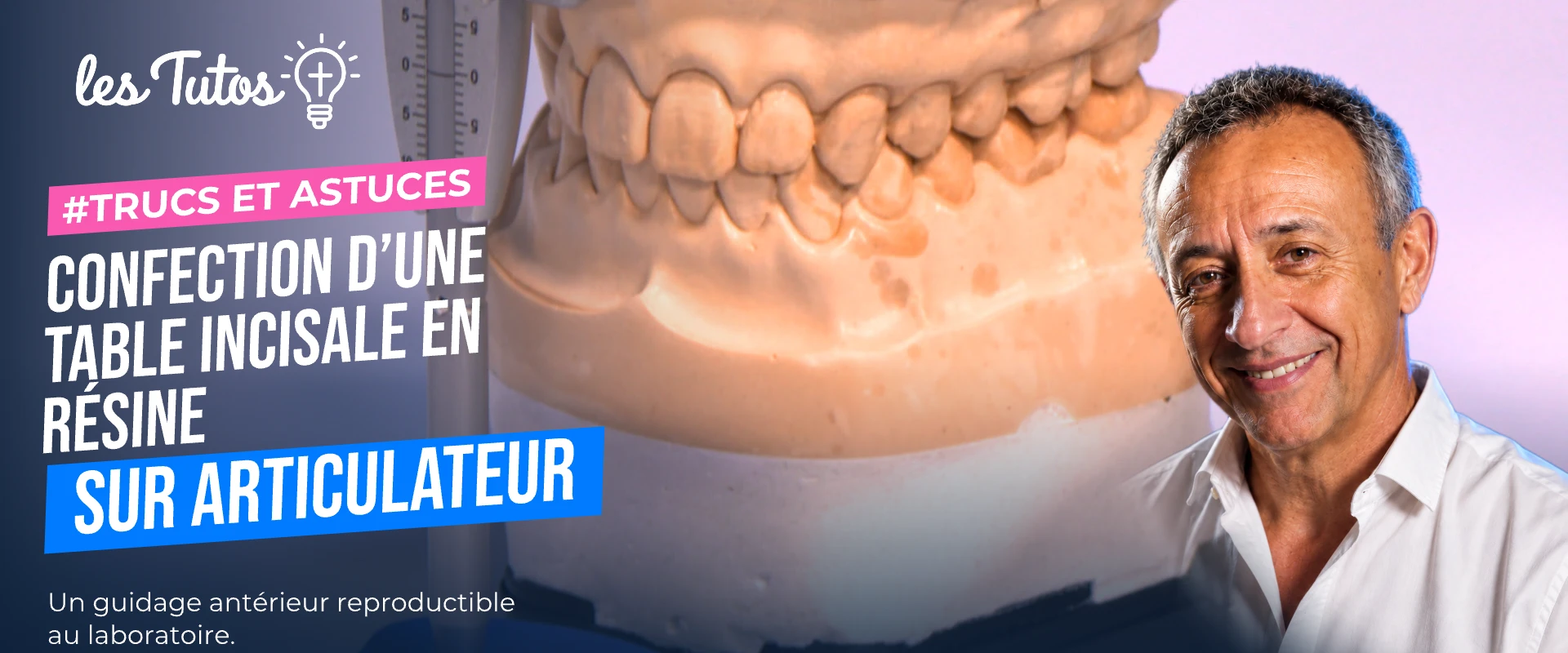 Confection d’une table incisale en résine sur articulateur