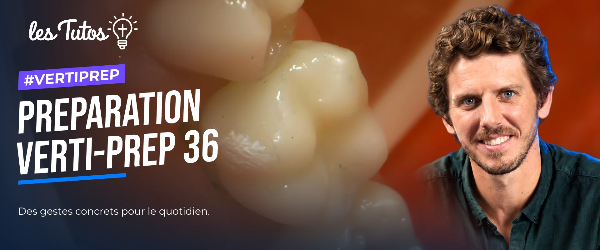 Preparation verti-prep 36 (Tuto, saison 2 épisode 21) : Démonstration muette : une préparation Verti-Prep sur la molaire 36, du build-up adhésif à…